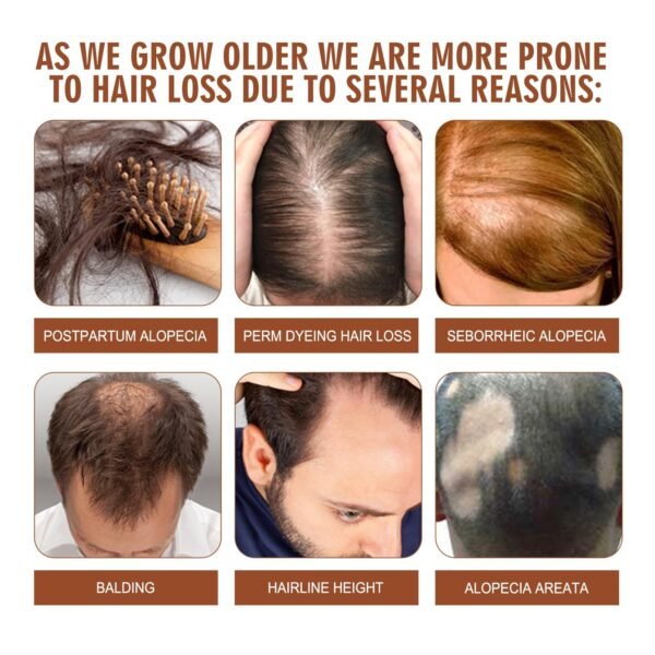 Batana Oil From Honduras - Get Fuller, Thicker, Healthier Hair - Great Gifts For Women  Men Conditioner Haircare Silky - Hair Nutrition - Image 9