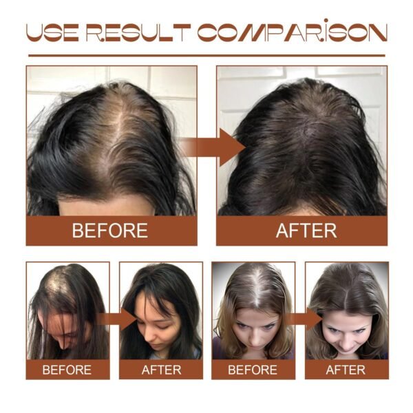 Batana Oil From Honduras - Get Fuller, Thicker, Healthier Hair - Great Gifts For Women  Men Conditioner Haircare Silky - Hair Nutrition - Image 5